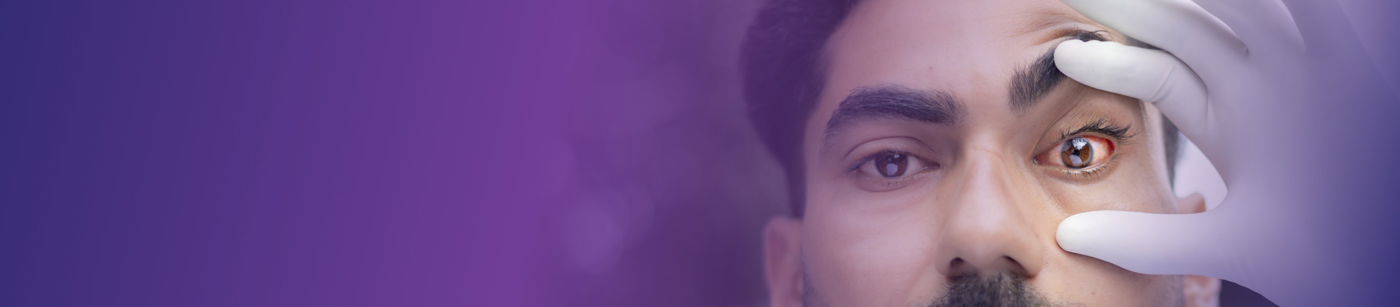 On this page learn more about glaucoma