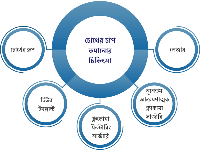 চিকিত্সার বিকল্পগুলি কি কি গ্লুকোমা জন্য উপলব্ধ?