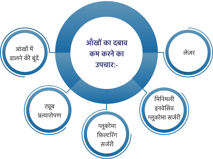 ग्लूकोमा के लिए उपचार के कौन से विकल्प उपलब्ध हैं?