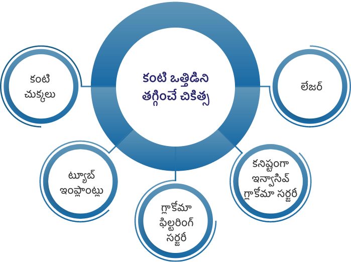 గ్లకోమా కోసం అందుబాటులో ఉన్న చికిత్సలు ఏంటి?