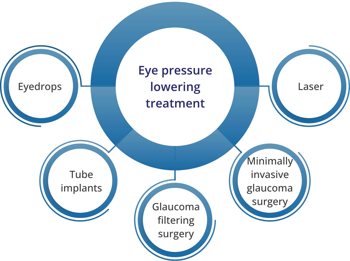 Eye pressure lowering treatment  Eyedrops  Tube implants Glaucoma filtering surgery Minimally invasive glaucoma surgery Laser